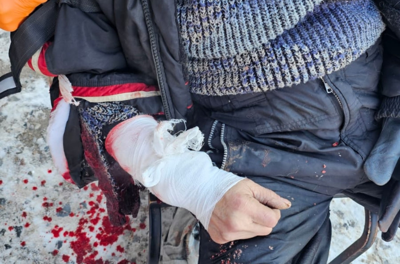 7 dead, 15 wounded in Druzhkivka market attack